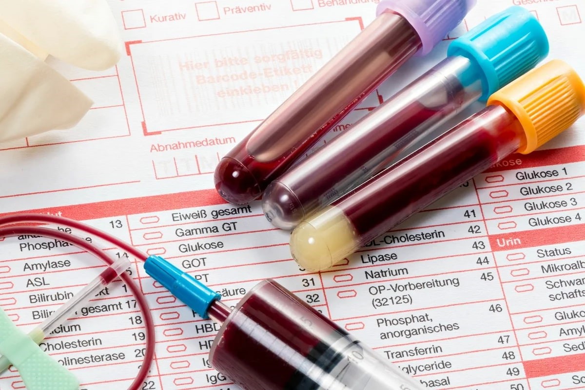 راهنمای تفسیر آزمایش خون